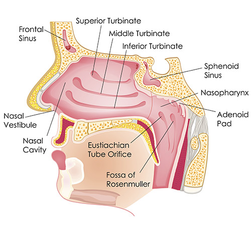 Nasal Congestion Diagram